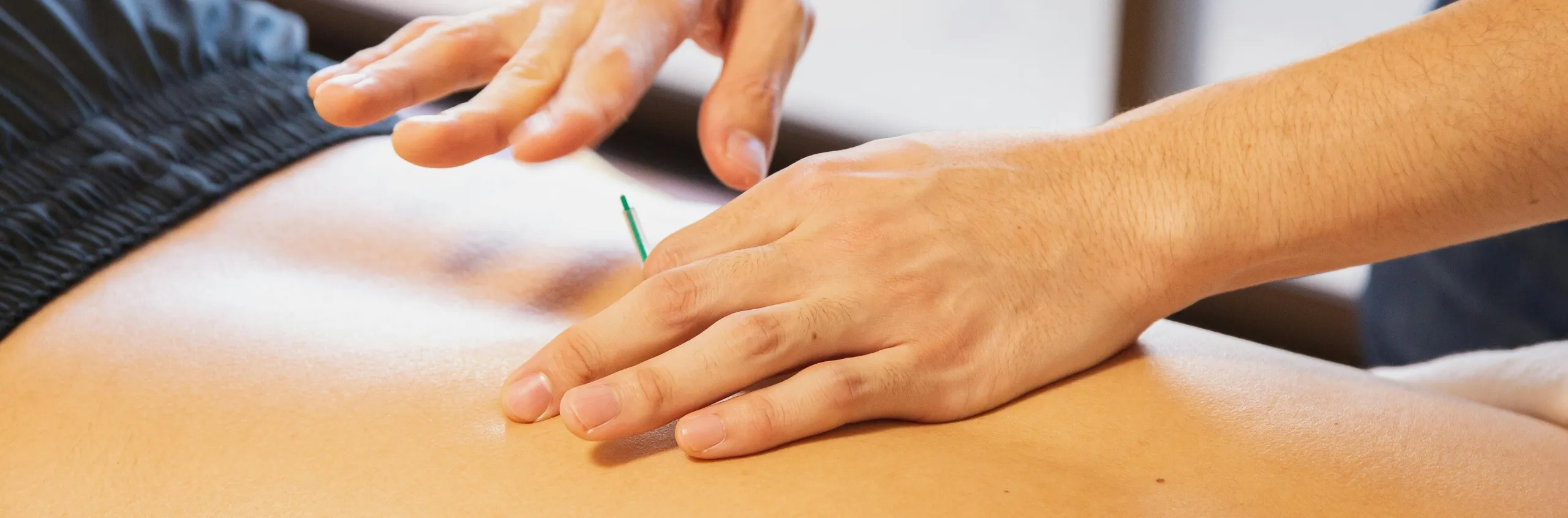 Dry Needling